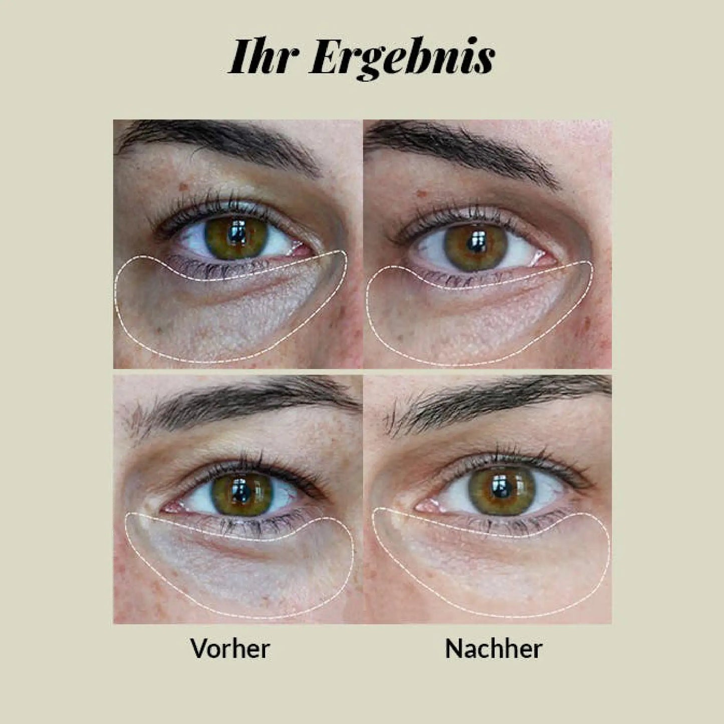 Nordic Cosmetics Oogcrème